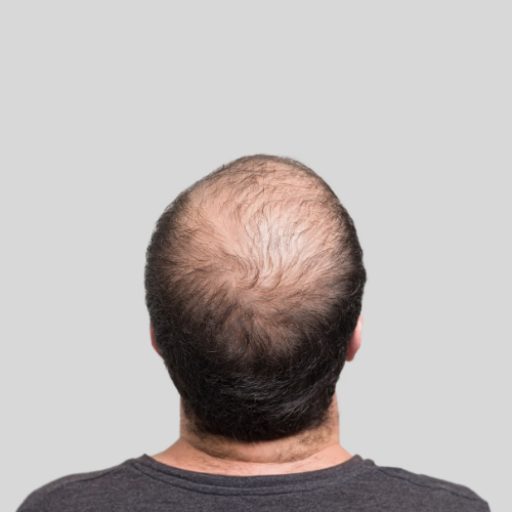Hair Loss Advisor logo